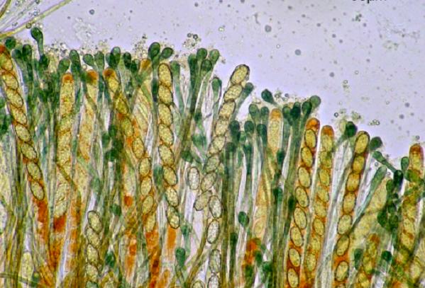 Foto microscopio optico de ascas, ascosporas y parafisis